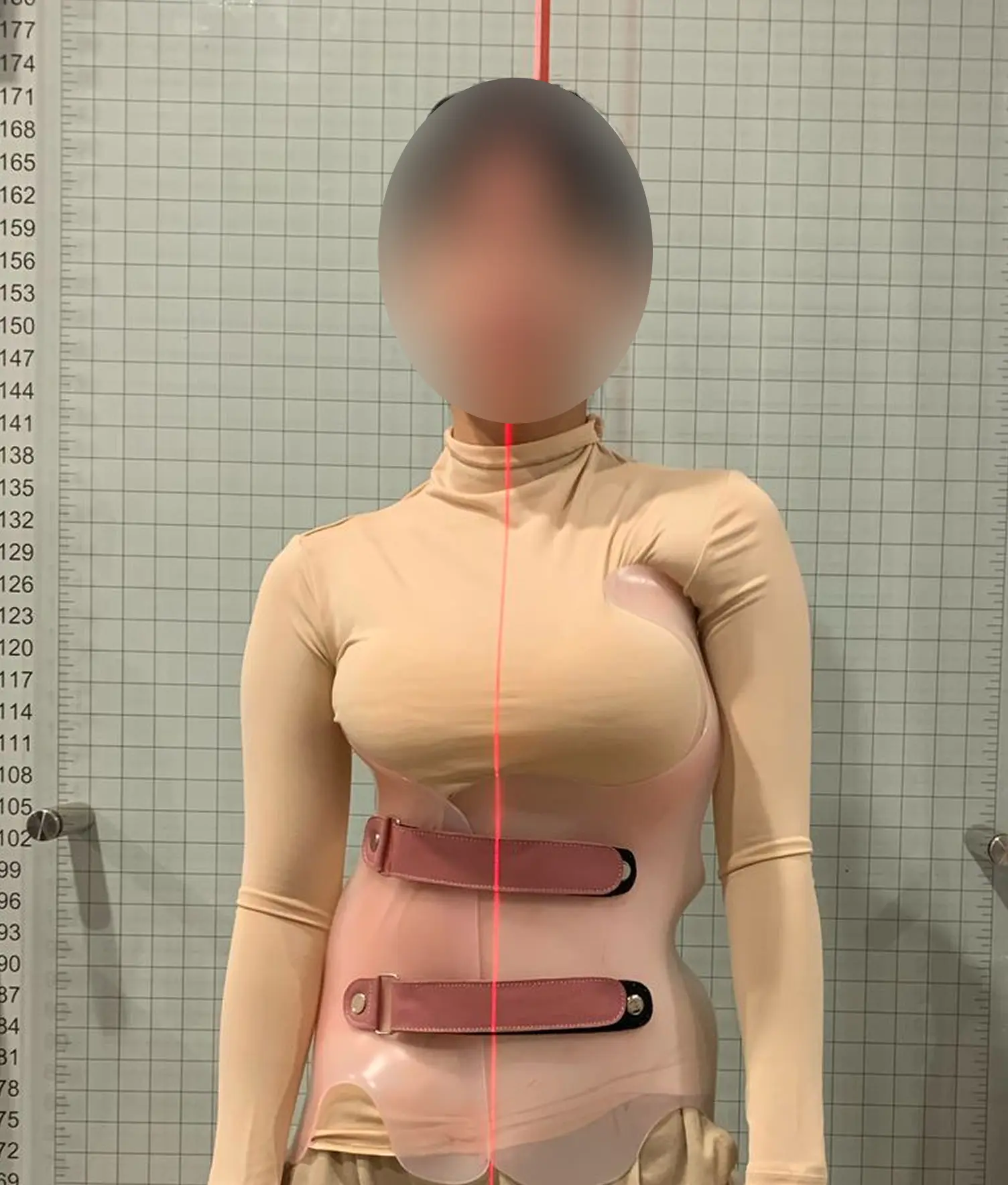 Brace Skoliosis Di Surabaya