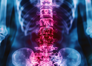 Rontgen X-ray skoliosis
